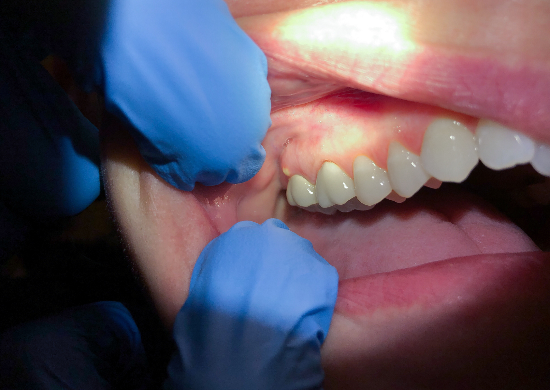 Dental Emergency in Europe? Here’s Exactly What American Travelers Should Do 3 Dental Emergency in Europe 4