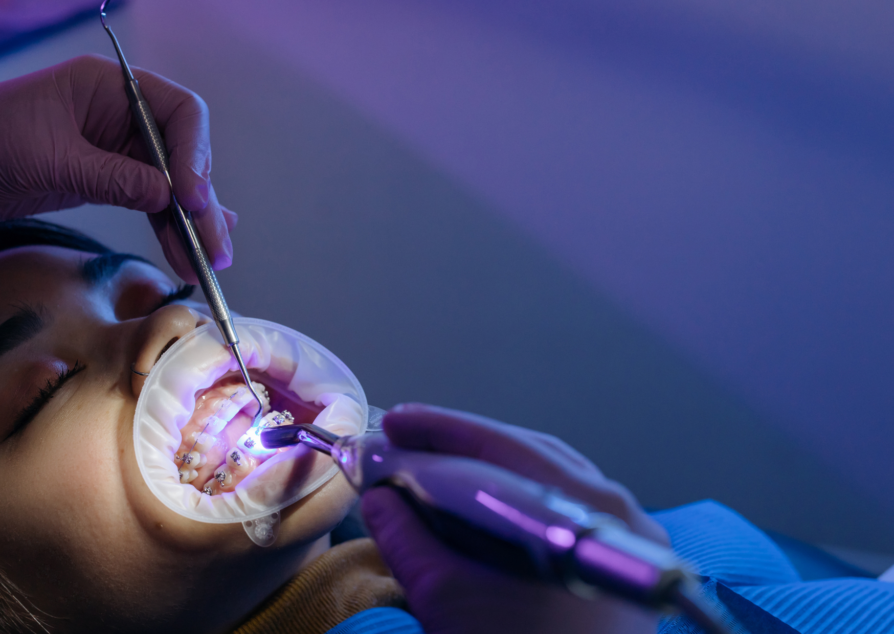 Dental Emergency in Europe? Here’s Exactly What American Travelers Should Do 4 Dental Emergency in Europe 6