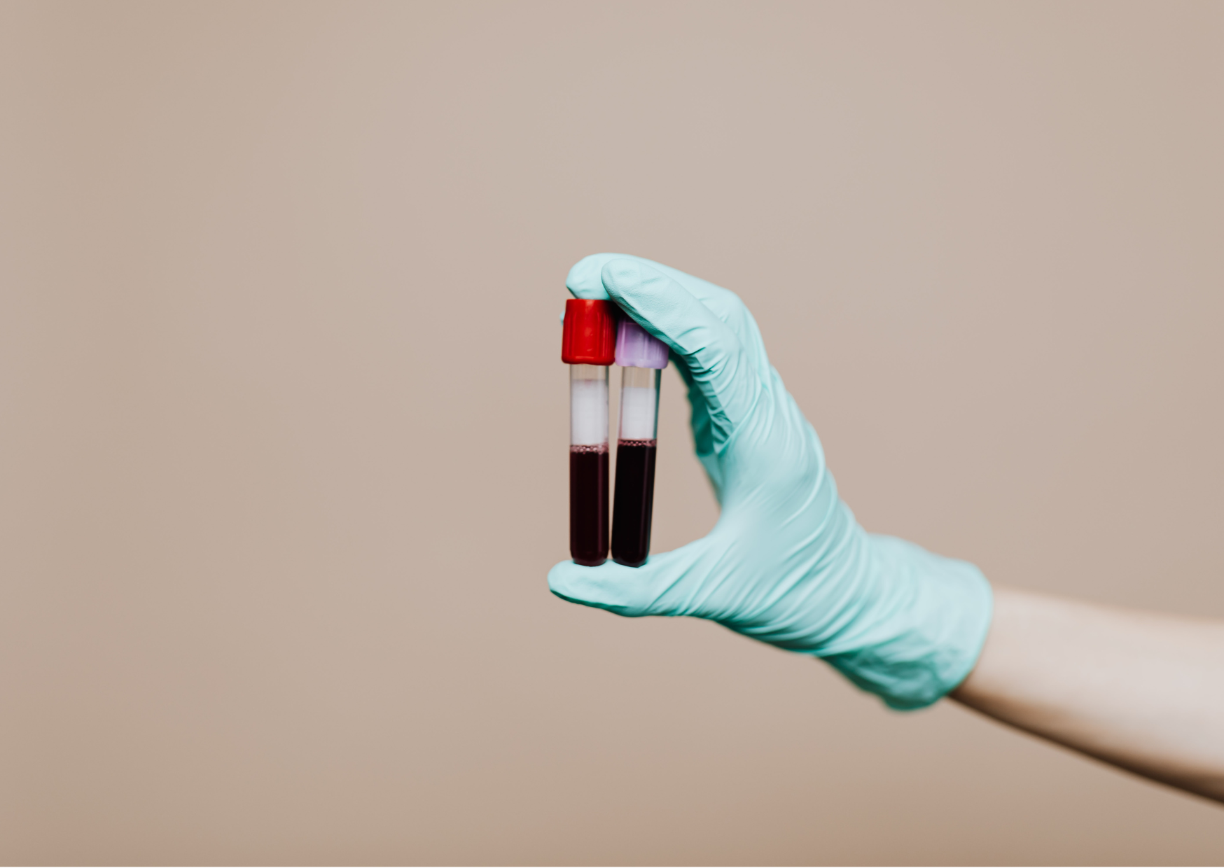 The Annual Blood Tests Europeans Do That Catch Problems a Decade Earlier 1 Annual blood tests 2