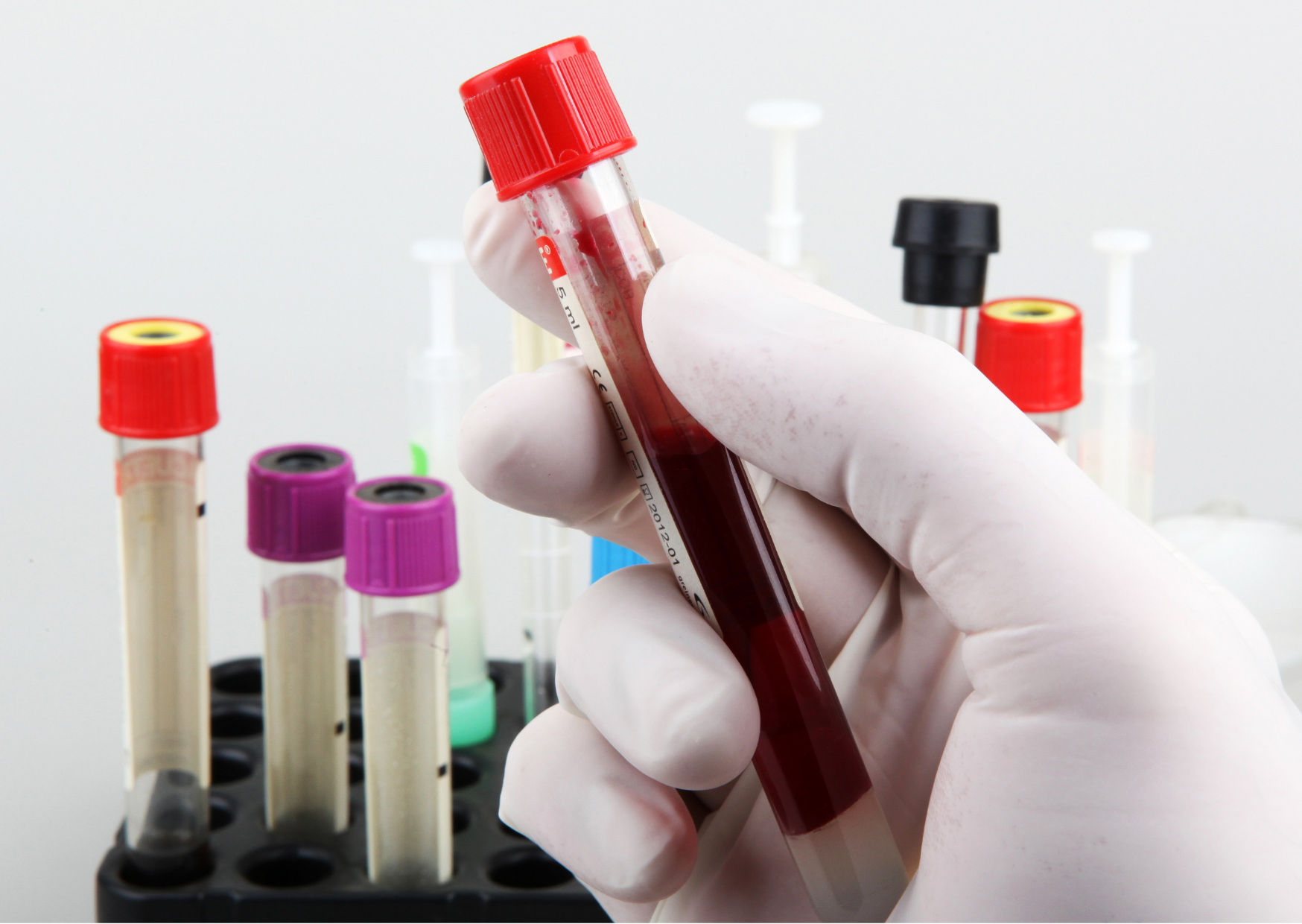 The Annual Blood Tests Europeans Do That Catch Problems a Decade Earlier 5 Annual blood tests 5