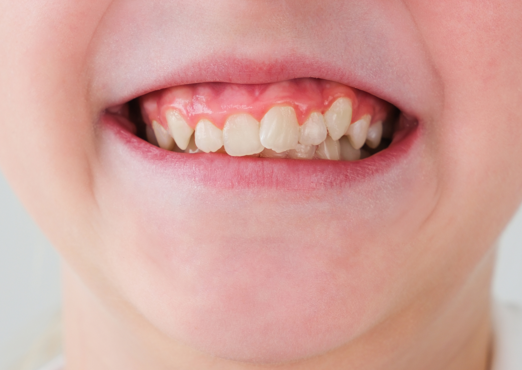 british teeth 3