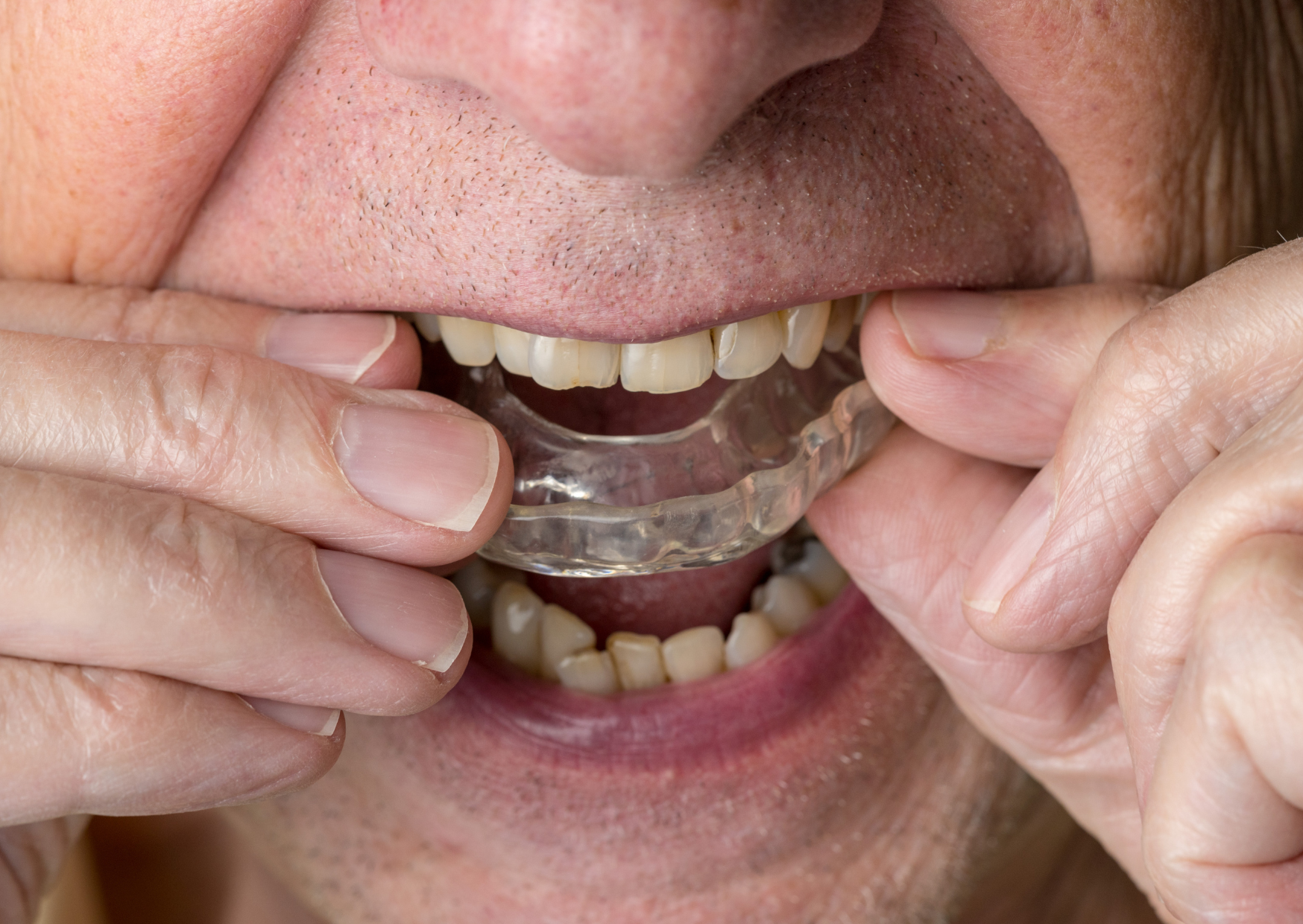 british teeth 5