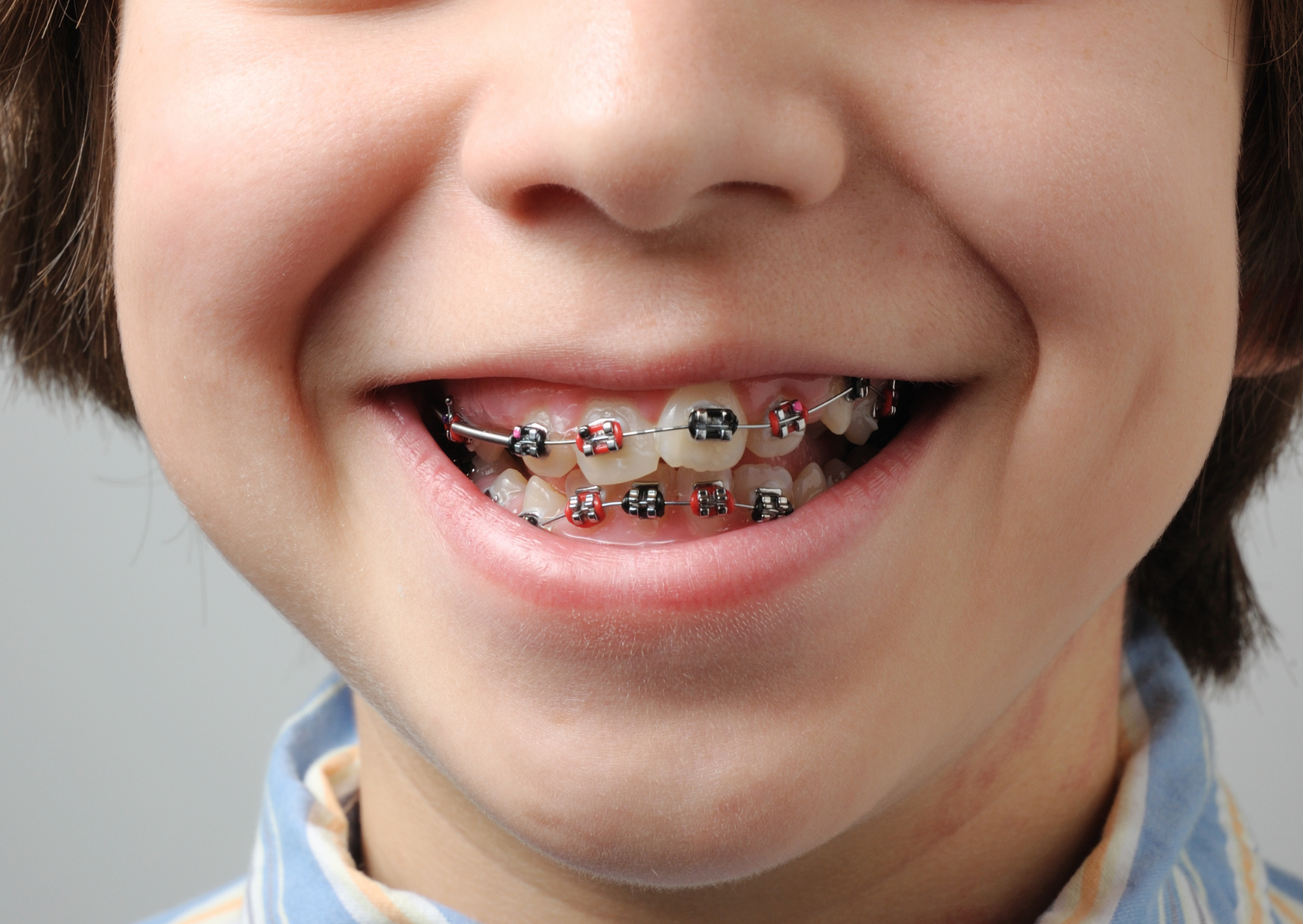 british teeth 6