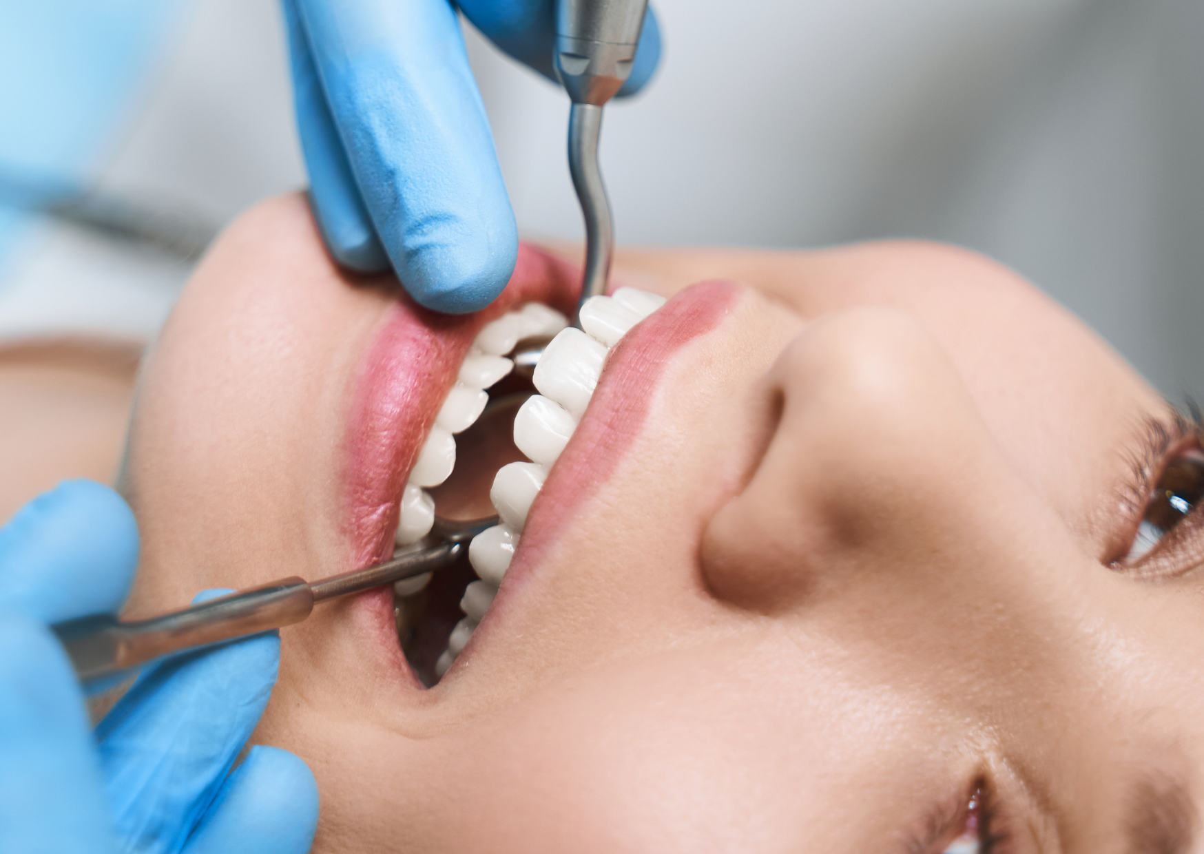 Portuguese Dentist Did Root Canal For €250 — U.S. Quote Was $3,200 3 root canal 3